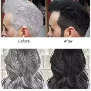 Apple Ammonia-Free Hair Color Dark Brown | Fruit Based Gentle Formula | No Irritation